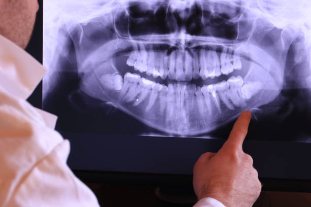 Best Emergency Wisdom Teeth Removal in Lake Ssota, WI