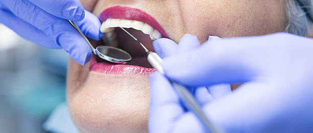 Best Emergency Treatment for Dental Infections or Abscesses in Lake Ssota, WI
